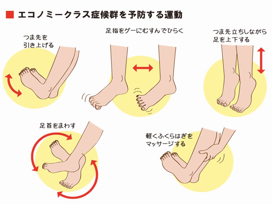 エコノミークラス症候群ってどんなもの？予防するには？