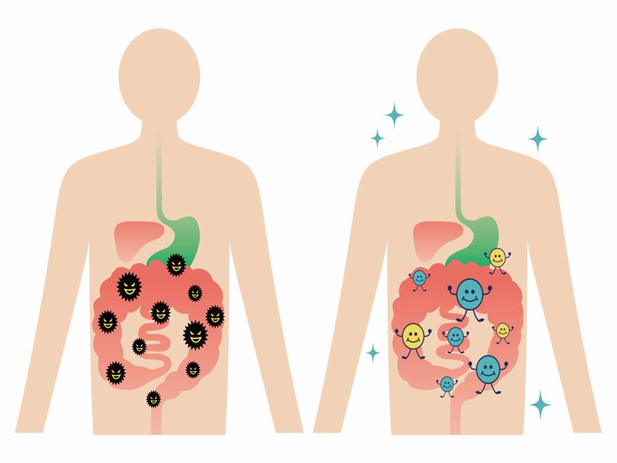 腸をきれいにしたら痩せる！5つの理由