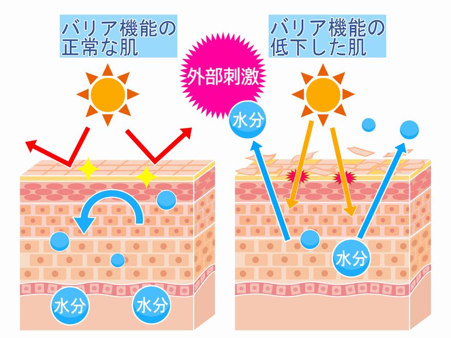 乾燥肌に気を付けよう