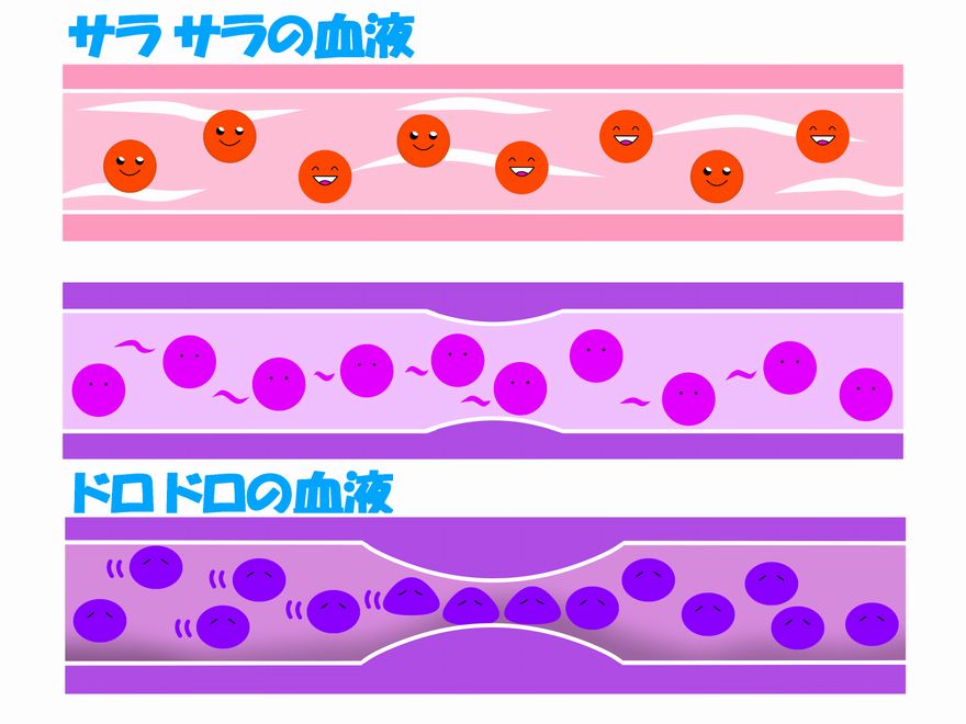 血液サラサラにする方法とは